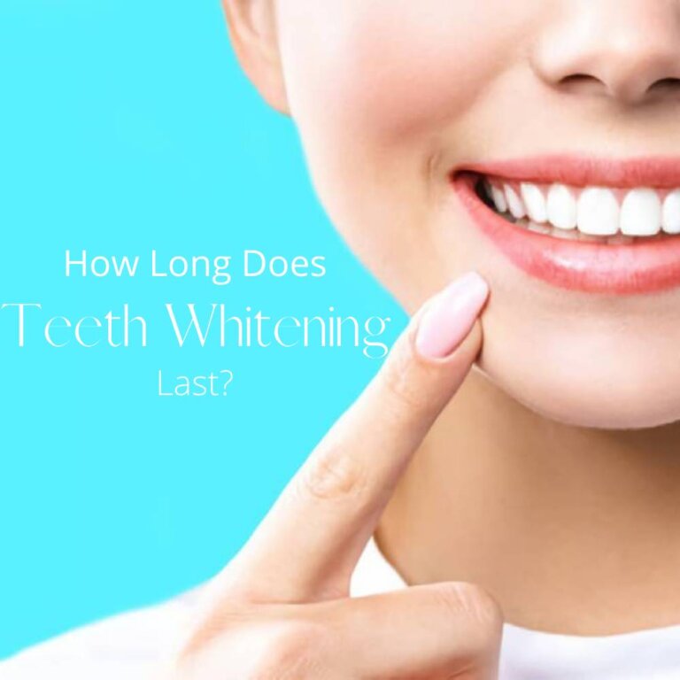 How Long Does Teeth Whitening Last