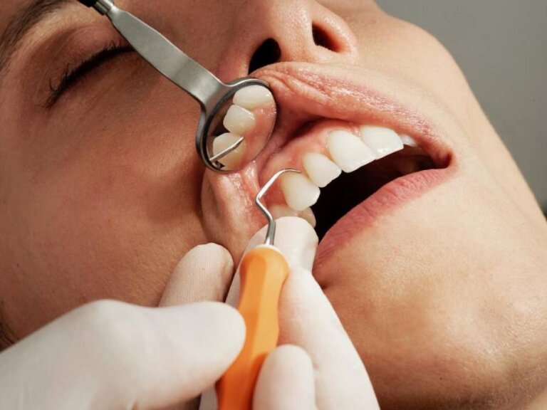 How To Take Care Of Dental Implants